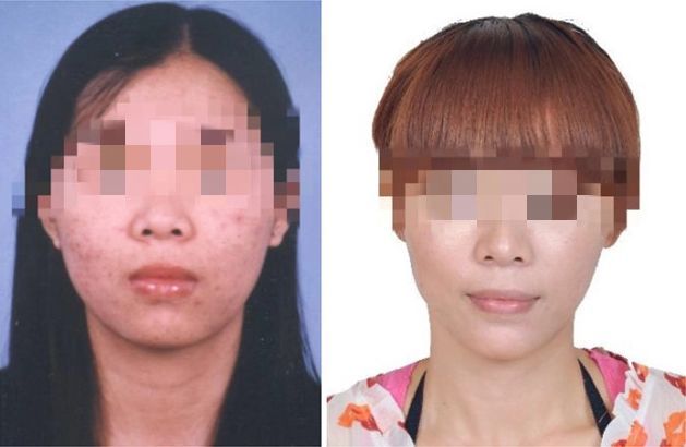 女子侵吞公司百万潜逃16年，整成“别人”仍被抓