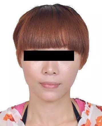 女子侵吞公司百万潜逃16年，整成“别人”仍被抓