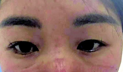 援鄂90后护士带来前线心声:大爷看到防护服上的青岛很激动……