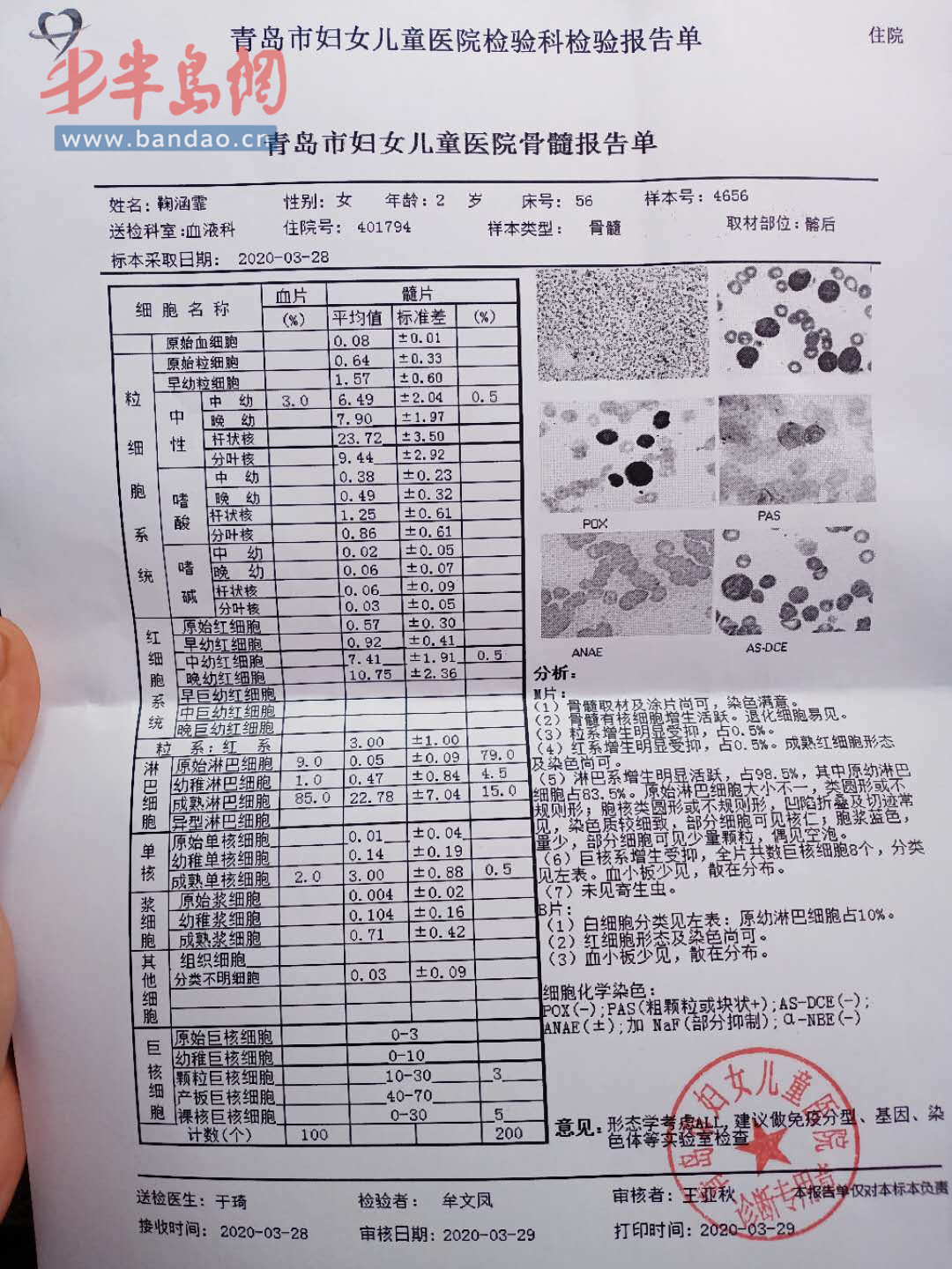 罹患■诸城2岁女童罹患急性白血病，急需爱心救助