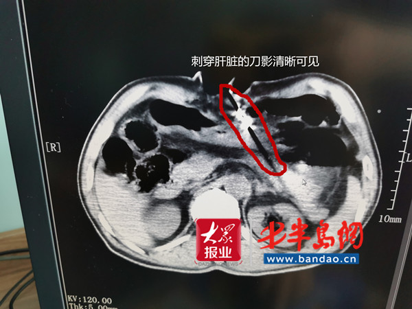 胶州|胶州男子家中轻生自杀后悔，打电话向妻子求救