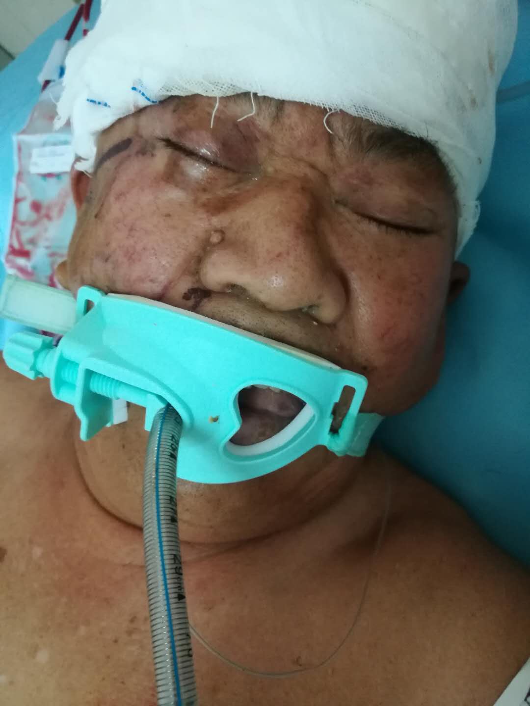 |男子摔倒受伤严重，诸城这家医院急寻病人家属！