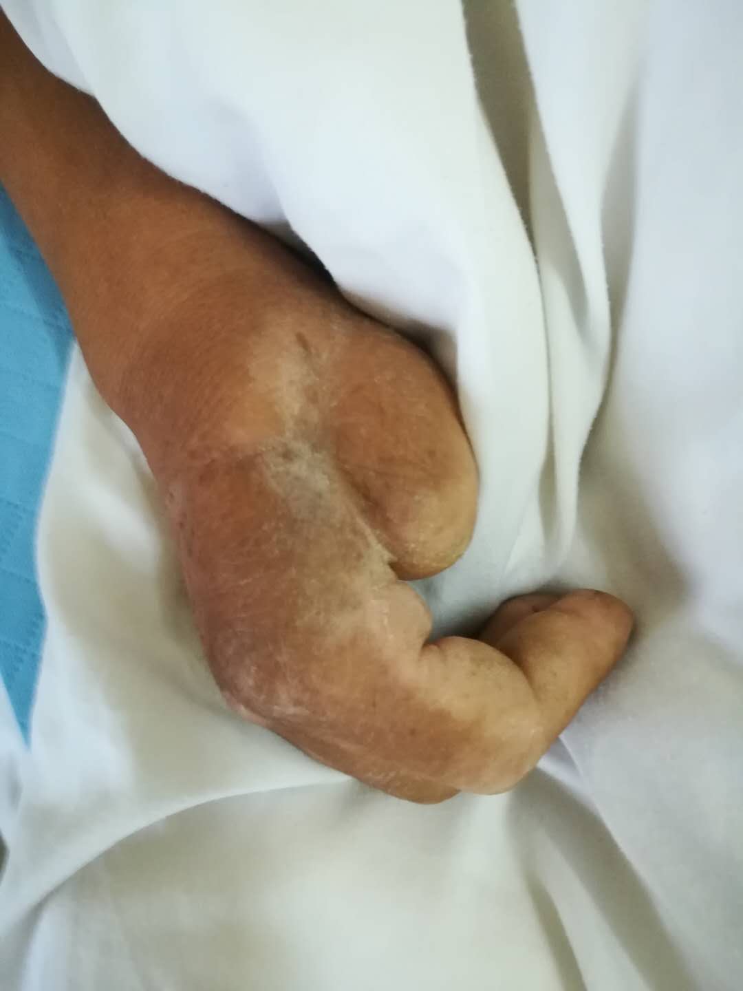 |男子摔倒受伤严重，诸城这家医院急寻病人家属！