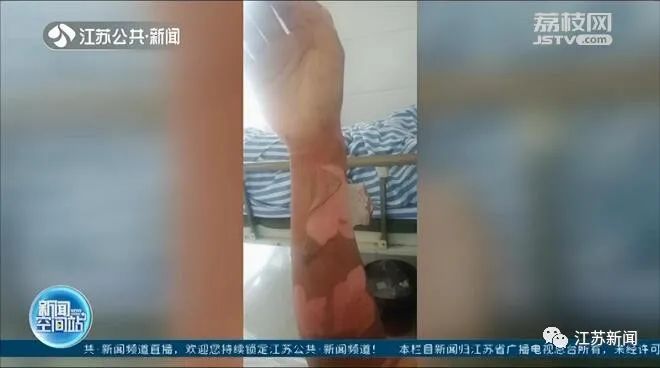 奇招|江苏淮安一男子用降温剂给爱车降温 正在炫耀成果突然车炸了