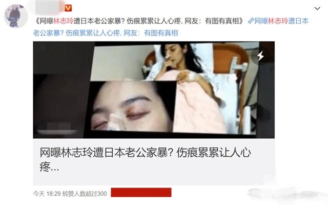 |不能生育遭老公家暴離婚？林志玲七夕曬照破謠言