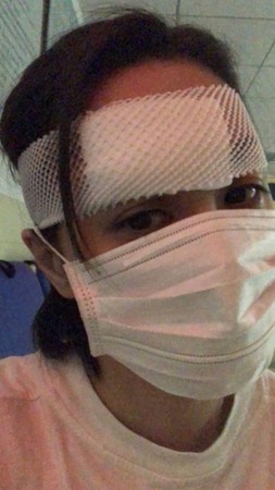 |阿娇伤势细节曝光：眉骨撕裂 或需要做第二次手术