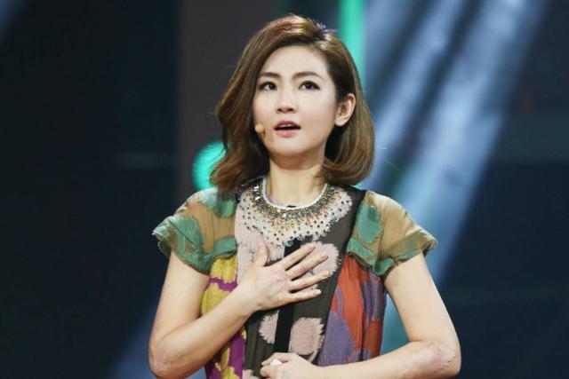 SHE|SHE都已接近不惑之年了！Selina庆祝39岁生日大方露出烧伤伤疤