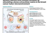上海专家揭示感觉神经是“最毒乳腺癌”免疫治疗耐药“元凶”