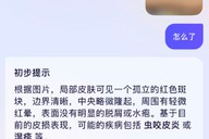 AI问诊，靠谱吗？