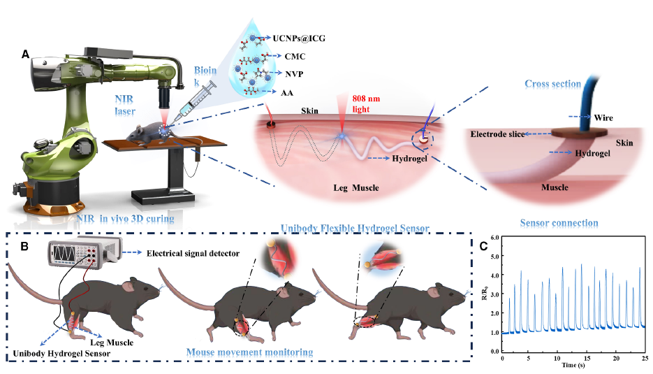 植入式无创传感器研发取得重要进展