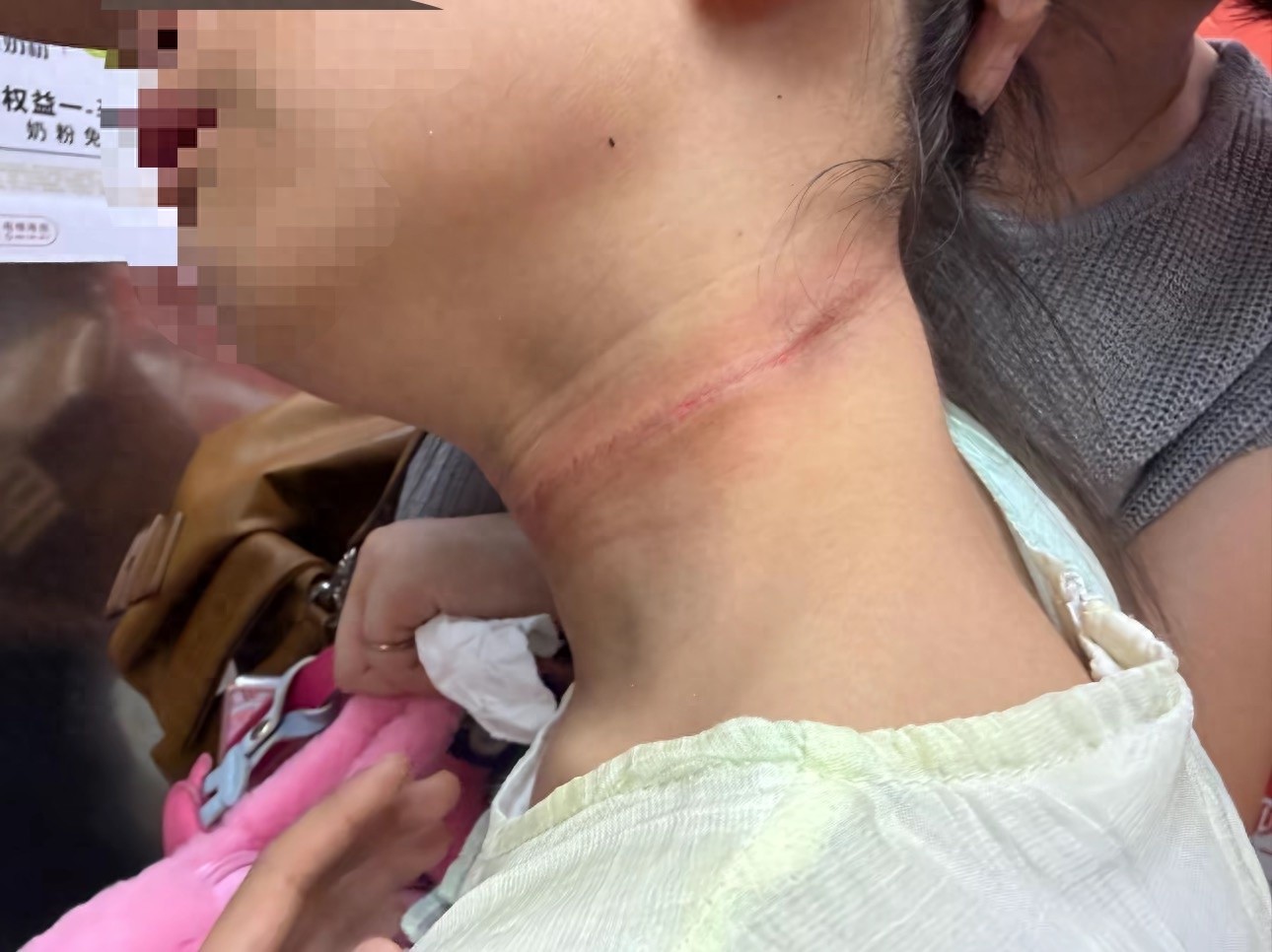 儿童攀岩被钢丝勒脖受伤：家长怀疑设备故障所致，园方称是个人操作失误
