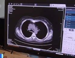 AI辅助诊疗系统上岗，AI医生开口问诊已成现实
