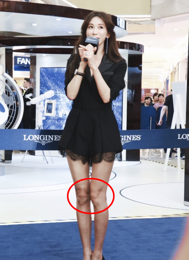 老了!林志玲膝盖带伤疤,褶皱不平惹人心疼