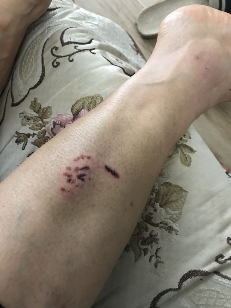 狗咬的伤痕的图片图片