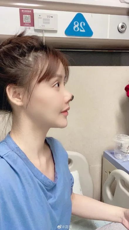 女演员高溜整容失败导致鼻坏死 失去片约还要赔偿200多万