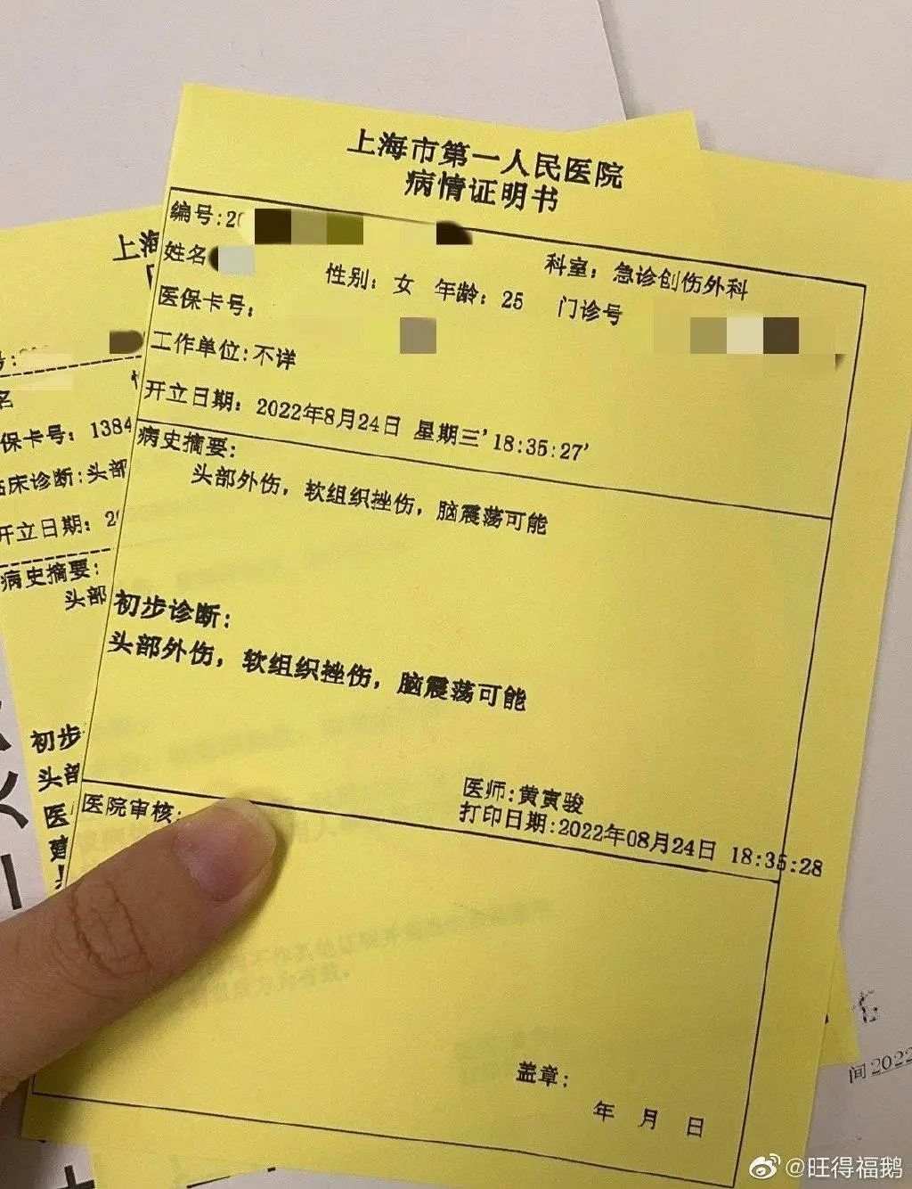 存在轻微脑震荡可能".